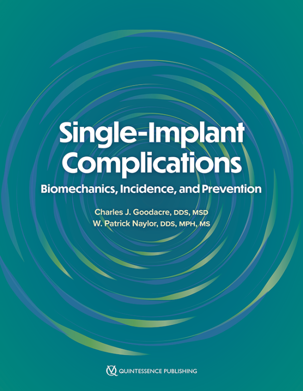 Single-Implant Complications Biomechanics, Incidence, and Prevention