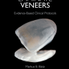 Laminate Veneers Evidence-Based Clinical Protocols