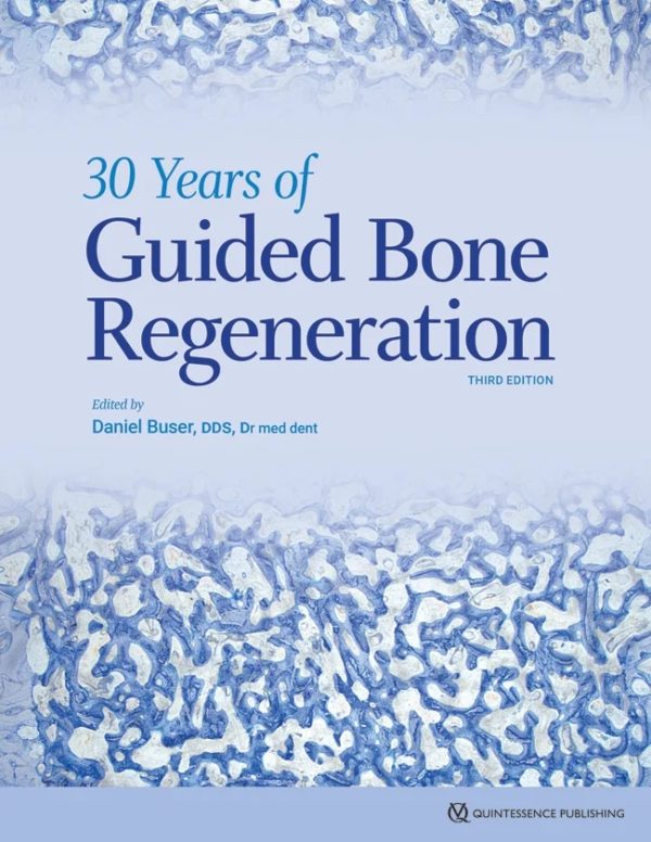 The book begins with the science of bone regeneration, describing how bone and soft tissue will react and behave under different circumstances, before delving into the different methods and uses of GBR based on the presenting scenario. How to properly time and stage grafting, implant, and prosthetic therapy is a major focus. Case examples are presented documenting each patient’s bone regeneration from start to finish, frequently with long-term follow-ups of 10 years or more. Emphasis is given to incision technique and flap design; the selection, handling, and placement of barrier membranes; the combination of membranes with autogenous bone grafts and low-substitution bone fillers; and aspects of wound closure. This book offers solutions for those who want to begin providing implants to a wider range of patients, for GBR veterans who want to refine their skills and practice more advanced techniques, and for implant surgeons who want to keep up to date with the most current research and technology in GBR.