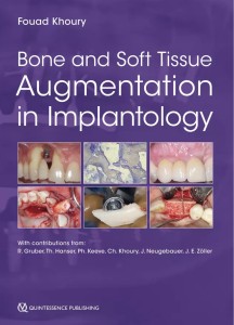 Uncover the secrets to successful bone and soft tissue augmentation in implantology with the comprehensive guide, "Bone and Soft Tissue Augmentation in Implantology." This essential resource provides a step-by-step approach to enhancing bone and soft tissue for optimal dental implant outcomes. From diagnosis to surgical techniques, this book covers a wide range of topics including ridge preservation, sinus augmentation, and soft tissue grafting. Whether you're an experienced implantologist or a dental professional looking to expand your skills, this book is a must-have reference for achieving predictable and esthetic results in implant dentistry. Elevate your practice with this indispensable guide.