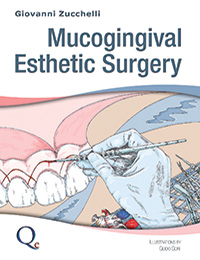 Mucogingival esthetic surgery is dedicated to the treatment of mucogingival esthetic alterations. These may be caused by gingival recession, often in association with abrasion and/or root caries or, conversely, altered passive eruption. The aims of mucogingival esthetic surgery may also be to augment gingival width and height around prostheses or implants and to fill out edentulous ridges. Techniques for edentulous ridge augmentation are addressed in the second volume. This volume describes and illustrates mucogingival surgical techniques as applied to native teeth or implants, with the chief aim of satisfying the patient's esthetic requirements.