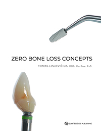 By combining clinical experience with peer-reviewed scientific evidence, the author of this book has put together a guide that any implant specialist will find invaluable to prevent bone loss in their patients. Different strategies are presented that can be used to achieve zero bone loss years after treatment. Because successful treatment depends on both the surgical and prosthetic components, the book is divided into two parts, each focusing in depth on what must be done in each phase to promote bone stability. Case presentations detail many types of clinical situations, implant choices, and prosthetic solutions, all backed by evidence-based clinical studies that have proven success.
