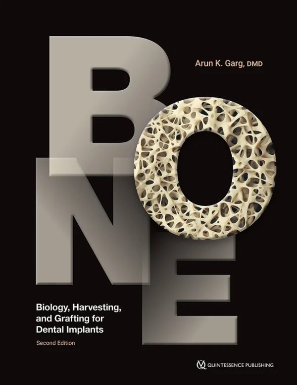 Dental implant placement often requires bone grafting to ensure sufficient bony support for the implants being placed. Depending on the biologic conditions of the patient, including the level of bone atrophy and the status of the remaining teeth in the mouth, more adjunctive procedures like bone harvesting or sinus grafting may be required. This book covers it all, from the biology of bone and how dental implants work within that framework to the many procedures for harvesting bone and using it to augment sites for implant placement. The different types of bone grafts and membranes are discussed as well as procedures to preserve the alveolar ridge following tooth extraction. Dr Garg was a pioneer in dental bone grafting, and this new edition keeps him at the forefront of the field.