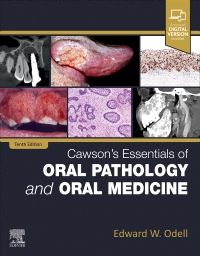 Delve into the fascinating world of oral pathology and oral medicine with the renowned textbook, "Cawson's Essentials of Oral Pathology and Oral Medicine." This comprehensive resource provides a comprehensive understanding of the diseases and conditions affecting the oral cavity and surrounding structures. With a focus on clinical relevance and practical application, this book covers a wide range of topics including oral cancer, salivary gland disorders, and oral manifestations of systemic diseases. Whether you're a dental student or a practicing oral healthcare professional, this textbook is an indispensable reference for diagnosing and managing oral pathologies. Stay informed with the latest knowledge in the field and enhance your clinical expertise.
