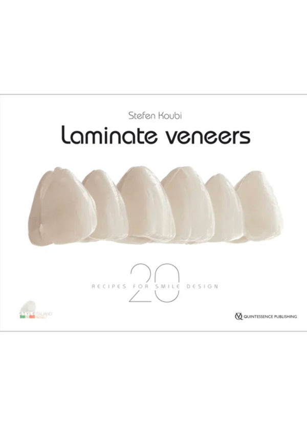 Laminate veneers