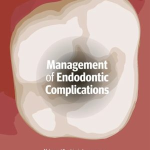 Based on decades of experience performing root canal treatment, these endodontic leaders explain their systematic approach for gathering pertinent medical and dental information, performing necessary tests, and analyzing the information to make informed decisions. This book guides readers through common errors and risk factors, recommendations for preventing mishaps, and methods to manage these challenges so clinicians can ultimately achieve results that provide long-term comfort, function, and esthetics for the patient. From diagnosis to prognosis, this book has you covered at any stage of endodontic treatment.