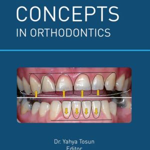 The main objective of this book is to introduce ways in which orthodontics can contribute to esthetic interdisciplinary treatments and to give young orthodontists tips in this regard. This book would also be beneficial for general dentists who want to improve their capabilities and the quality of their dental work by collaborating with the orthodontist.