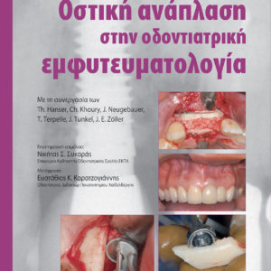 Οστική ανάπλαση στην οδοντιατρική εμφυτευματολογία
