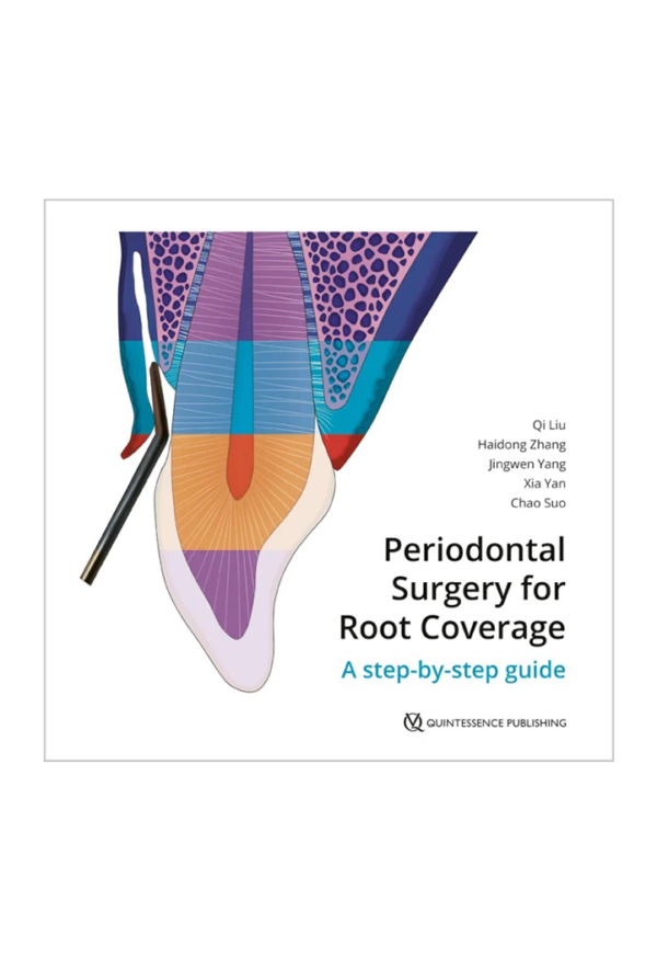 Periodontal Surgery for Root Coverage