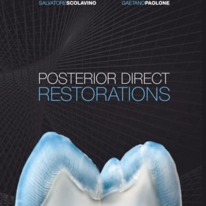 This book achieves the ambitious aim of showing dentists how to create conservative and esthetic direct restorations of posterior teeth using composite resin. The book begins with a primer on occlusal anatomy, describing the specifics of each type of posterior tooth. This foundation supports the diagnosis and treatment of lesions, isolation, and cavity preparation for the buildup, as well as modeling, detailing, and finishing of restorations that closely mimic natural tooth anatomy for optimal esthetics and function. Numerous clinical tips and case examples are provided, and the procedural rationale is supported by scientific evidence, in addition to the authors’ considerable clinical experience. Techniques for a wide range of clinical scenarios are presented to provide practitioners with the information they need to achieve optimal restorations.