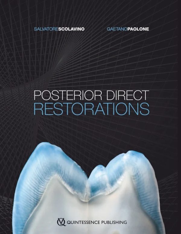 This book achieves the ambitious aim of showing dentists how to create conservative and esthetic direct restorations of posterior teeth using composite resin. The book begins with a primer on occlusal anatomy, describing the specifics of each type of posterior tooth. This foundation supports the diagnosis and treatment of lesions, isolation, and cavity preparation for the buildup, as well as modeling, detailing, and finishing of restorations that closely mimic natural tooth anatomy for optimal esthetics and function. Numerous clinical tips and case examples are provided, and the procedural rationale is supported by scientific evidence, in addition to the authors’ considerable clinical experience. Techniques for a wide range of clinical scenarios are presented to provide practitioners with the information they need to achieve optimal restorations.