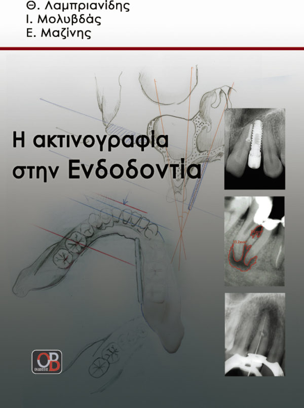 Ένα σύγχρονο επιστημονικό βιβλίο του τεκμηριώνει τη μέχρι τώρα έρευνα και κλινική εμπειρία πάνω στην ακτινογραφία στην ενδοδοντία. Περιέχει συνολικά έντεκα κεφάλαια, τα οποία είναι τα εξής: βασικά στοιχεία ακτινογραφίας, τεχνικές ακτινογράφησης, σύγχρονες ακτινογραφικές απεικονιστικές τεχνικές στην ενδοδοντία, προβλήματα κατά τη λήψη, εμφάνιση και στερέωση πλακιδίων, η συμβολή της ακτινογραφίας στη διάγνωση, η συμβολή της στη διάγνωση τραυματικών βλαβών, στη διάγνωση και αξιολόγηση ενδοδοντικών θεραπειών, στην επιλογή του θεραπευτικού σχήματος, η συμβολή της στα στάδια της συντηρητικής ενδοδοντικής θεραπείας και στη χειρουργική ενδοδοντία, στη διάγνωση και αντιμετώπιση ιατρογενών συμβαμάτων κατά τη διάρκεια της ενδοδοντικής θεραπείας και τέλος η συμβολή της ακτινογραφίας στην αξιολόγηση του θεραπευτικού αποτελέσματος στην ενδοδοντία. Να τονίσουμε πως σε όλα τα κεφάλαια δόθηκε ιδιαίτερη έμφαση στην τεκμηρίωση, με σχεδιαγράμματα, φωτογραφίες και ακτινογραφίες από χαρακτηριστικά κλινικά περιστατικά.