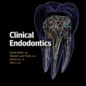 This straightforward clinical manual covers everything dentists need to know about basic endodontics. The essentials of endodontic examination and diagnosis, pharmacology, surgical and nonsurgical treatment, vital pulp therapy, emergency treatment, complication management, and more are all reviewed here. The quick guide accompanying the main text is an invaluable reference tool, providing step-by-step instructions for performing procedures and lists of required materials to ensure a well-stocked clinic.