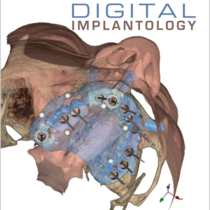 Digital Implantology