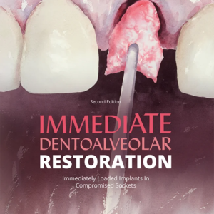 Single-tooth replacement in the esthetic zone is one of the most common indications for dental implant placement. Immediate dentoalveolar restoration (IDR) is a technique established to broaden indications for immediate loading on individual teeth with compromised hard or soft tissue architecture. With this protocol, lost tissues are reconstructed in the same surgical session as implant placement and provisional crown delivery, reducing the number of interventions and promoting better esthetics with greater predictability. This book provides step-by-step explanation of the protocols for IDR, featuring minimally invasive and flapless procedures, use of the maxillary tuberosity for graft harvesting, immediate loading, and correct crown contouring for adequate emergence profile. Many clinical cases of different complexity are demonstrated to highlight the versatility of this technique and the excellent outcomes possible.