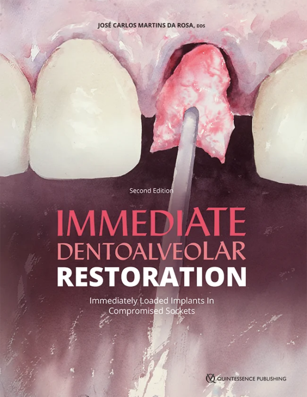 Single-tooth replacement in the esthetic zone is one of the most common indications for dental implant placement. Immediate dentoalveolar restoration (IDR) is a technique established to broaden indications for immediate loading on individual teeth with compromised hard or soft tissue architecture. With this protocol, lost tissues are reconstructed in the same surgical session as implant placement and provisional crown delivery, reducing the number of interventions and promoting better esthetics with greater predictability. This book provides step-by-step explanation of the protocols for IDR, featuring minimally invasive and flapless procedures, use of the maxillary tuberosity for graft harvesting, immediate loading, and correct crown contouring for adequate emergence profile. Many clinical cases of different complexity are demonstrated to highlight the versatility of this technique and the excellent outcomes possible.