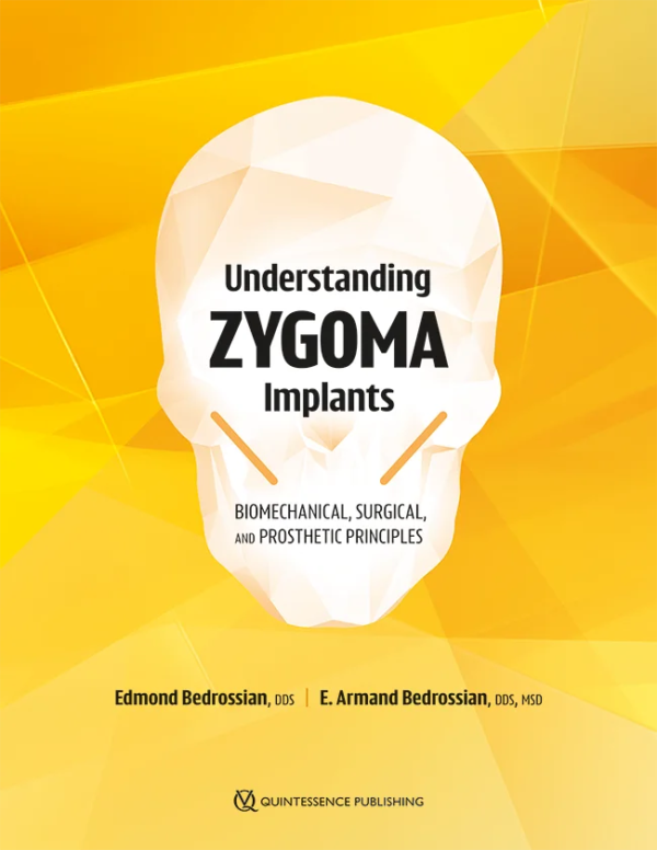 Treatment planning zygoma implants and understanding their indications can be complicated. This text takes the guesswork out of zygoma implant therapy by teaching readers to understand the anatomical, biomechanical, and prosthetic aspects of zygoma implant therapy and cross-arch stabilization. Emphasis is given to the basic biomechanical principles underlying appropriate treatment methods and prosthetic care. Avoid surgical and prosthetic complications and achieve patient satisfaction by following the outlined principles and protocols. Tips for coordinating implant treatment from start to finish are included.