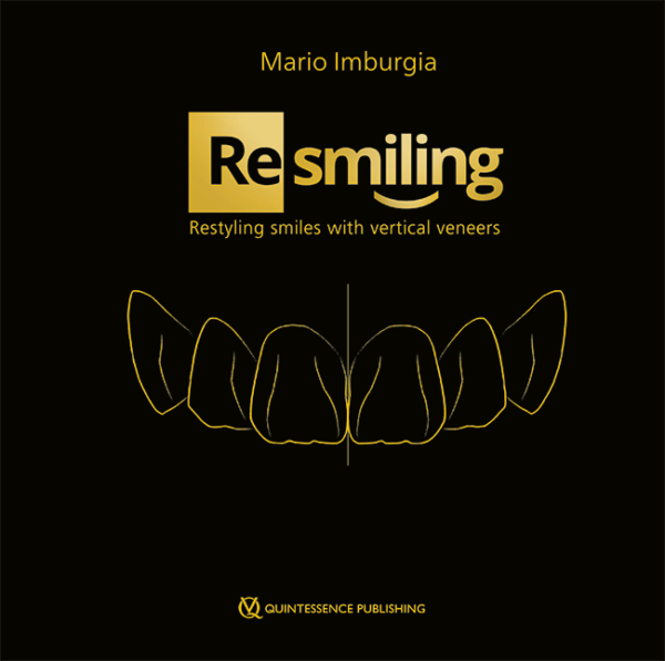 (Re)smiling Restyling smiles with vertical veneers