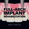 Full-Arch Implant Rehabilitation