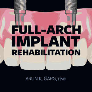 Full-Arch Implant Rehabilitation