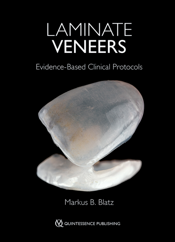 Laminate Veneers Evidence-Based Clinical Protocols