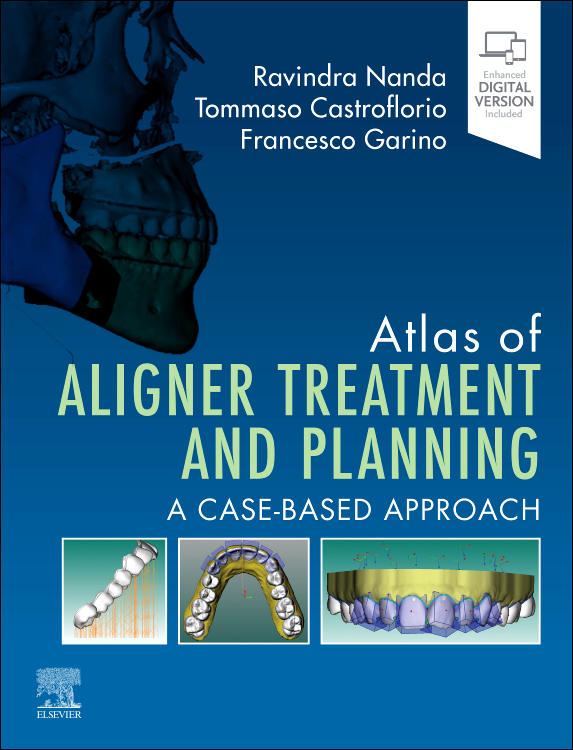 Atlas of Aligner Treatment and Planning, 1st Edition A Case-Based Approach