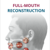 Full-Mouth Reconstruction